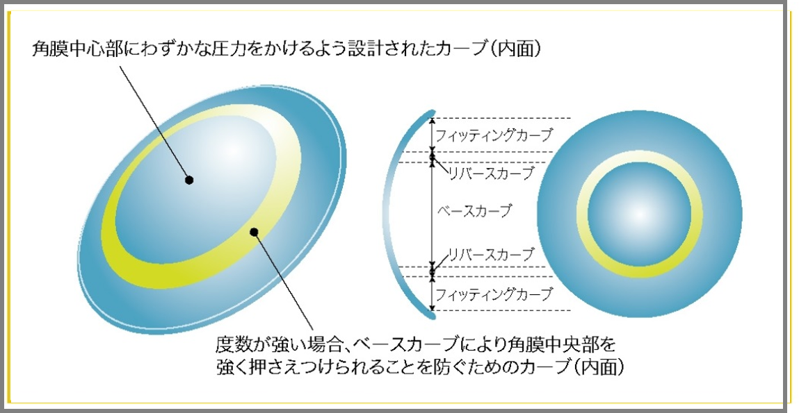 オルソケラトロジーレンズ基本デザイン2